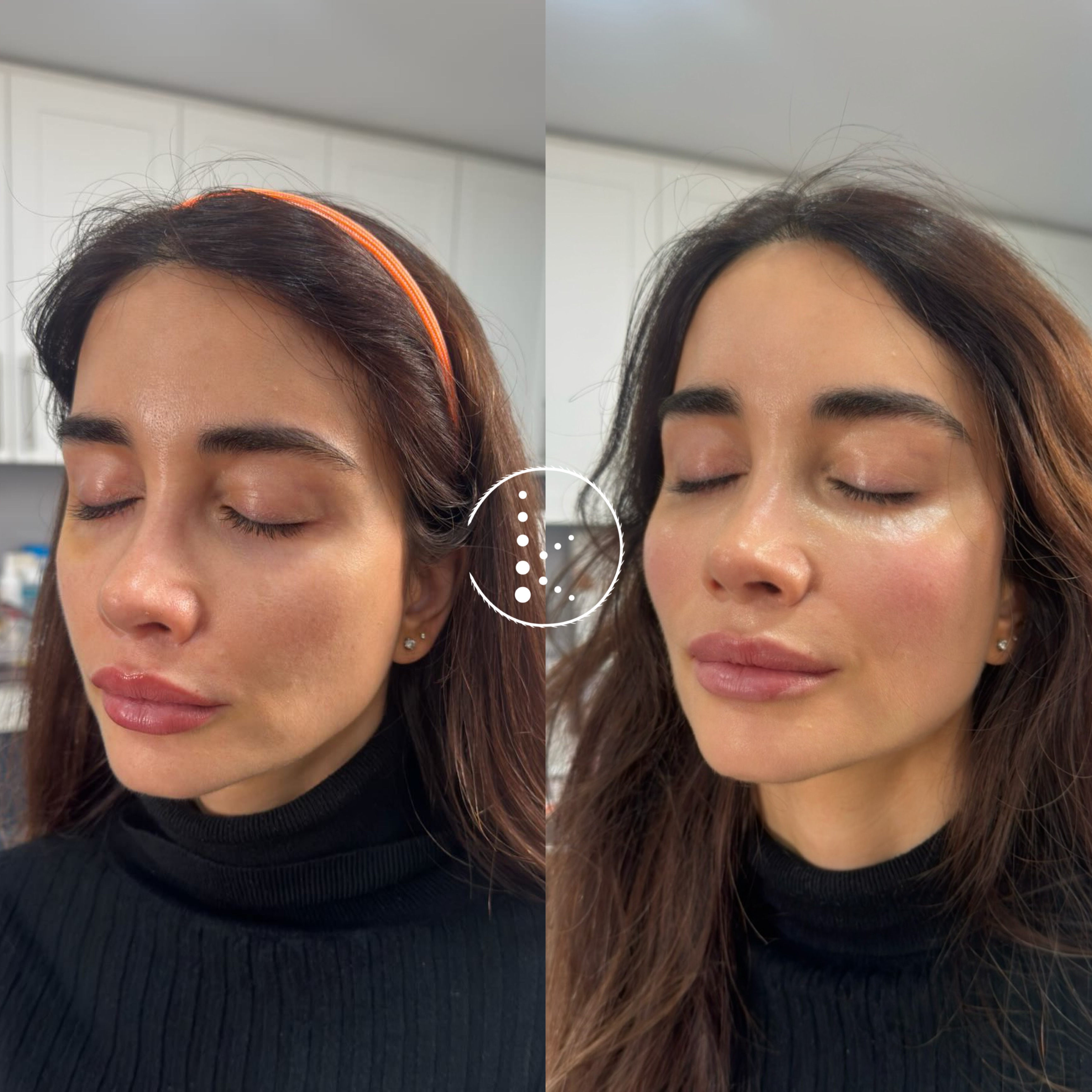 Case 012 · Lower Face & Jawline